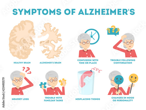 Alzheimer disease symptoms infographic. Memory loss and problem