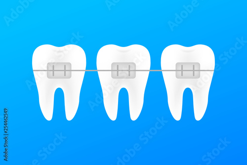 Correction of teeth with orthodontic braces. Stages of teeth alignment. Dental clinic services. Vector illustration.