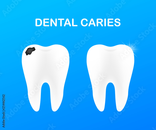 Stage of development of caries. Dental care concept. Healthy Teeth. Vector illustration.