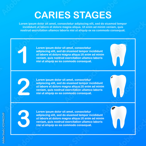 Stage of development of caries. Dental care concept. Healthy Teeth. Vector illustration.