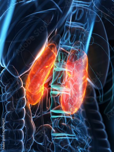 3d rendered medically accurate illustration of diseased kidneys