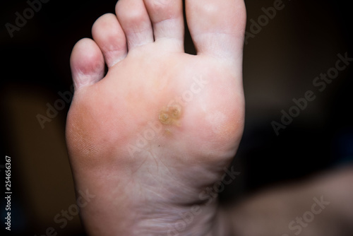 Tableau sur toile Corn on foot close up