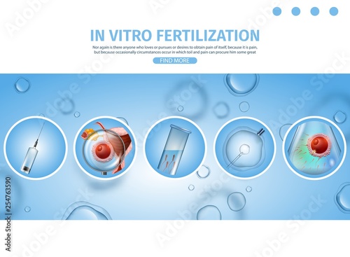 IVF Process Procedures Schematic Explanations.