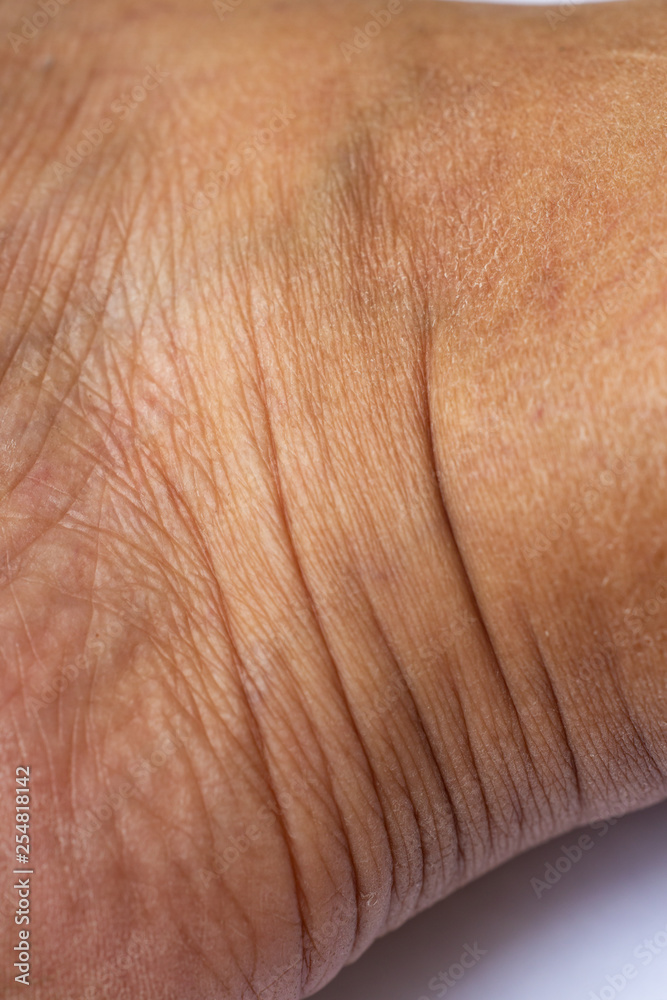 Fototapeta premium Woman's dry skin on ankle, Close up & Macro shot, Asian Body skin part, Healthcare concept, Abstract background