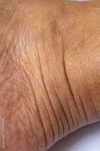 Woman's dry skin on ankle, Close up & Macro shot, Asian Body skin part, Healthcare concept, Abstract background