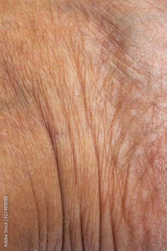 Woman's dry skin on ankle, Close up & Macro shot, Asian Body skin part, Healthcare concept, Abstract background