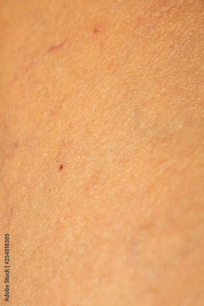 Fototapeta premium Woman's scar skin on leg, Close up & Macro shot, Asian Body skin part, Healthcare concept, Abstract background