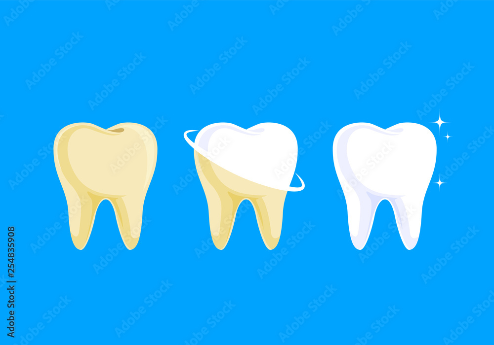 step of whitening tooth. Teeth Whitening. Dental care Concept. Vector illustration isolated on blue background.
