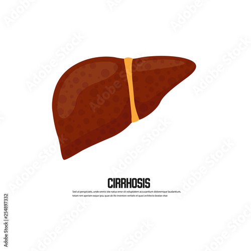 Cirrhosis of the liver vector illustration