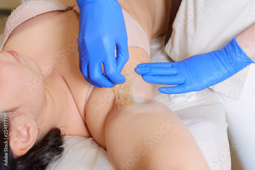 Master of sugaring making hair removal procedure for woman. Summer season vacation preparation. Epilation with liquate sugar paste. Treatment In Cosmetic Beauty Clinic. Beautician waxing female armpit