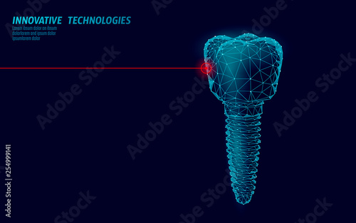 Tooth implant low poly medicine concept. Stomatology innovation technology dental banner template vector illutration