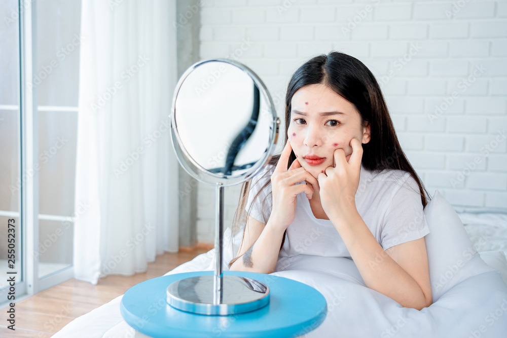 Asian teenage woman looking at mirror and squeeze acne problem on her face, skin care concept. Asian teenage woman looking at mirror and squeeze acne problem on her face, skin care concept.