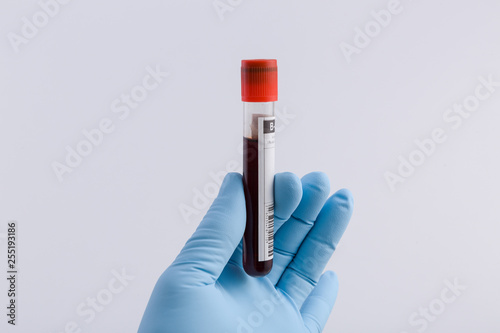 Doctor's hand with medical glove holds an tube with a blood probe