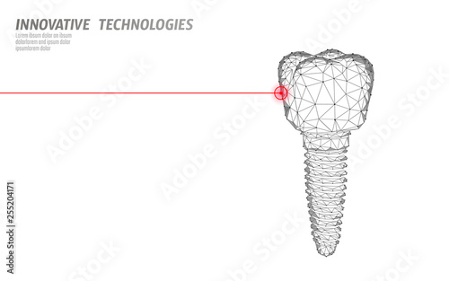 Tooth implant low poly medicine concept. Stomatology innovation technology dental banner template vector illutration