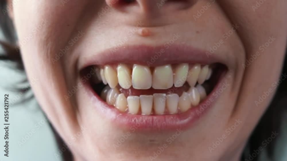 girl's mouth laughing loudly close up girl's mouth laughing loudly close up