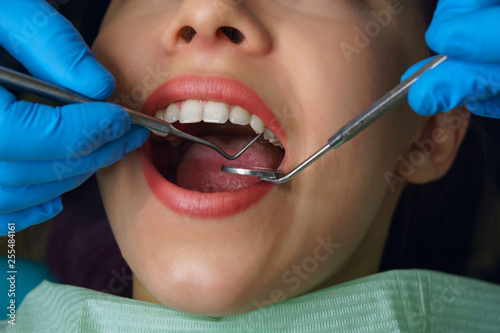 Dentist examines teeth women. Young girl with open mouth. White teeth. Dentist hands with medical instruments. Close-up. Dental clinic.