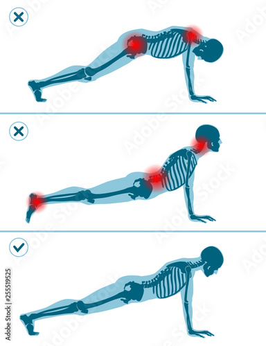 Wrong and correct plank pose. Right and wrong execution technique of sport exercise. Common mistakes in sport workout. Man standing on hands before push ups.