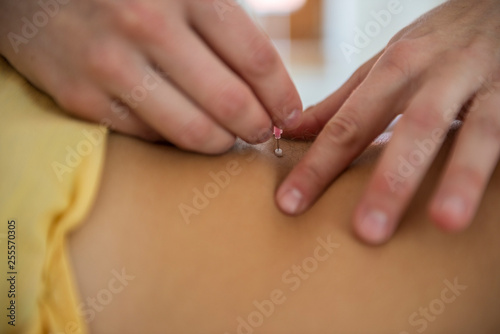 close up detail of acupuncture needles in back neck
