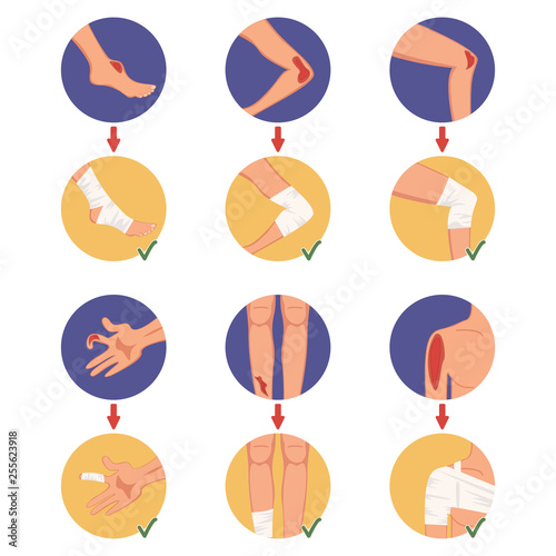 Open tear, damaged shoulder, elbow, finger, foot, knee, leg and medical dressing set