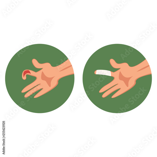 Open torn cut, wound bruised finger and medical dressing