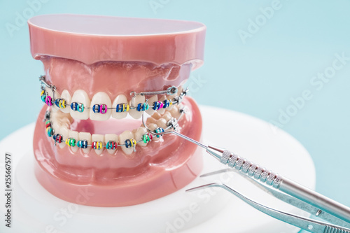 Dentist tools and orthodontic model on blue background.