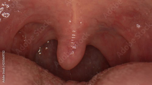 Macro close-up of the inside of a human mouth as the uvula dangles and moves around