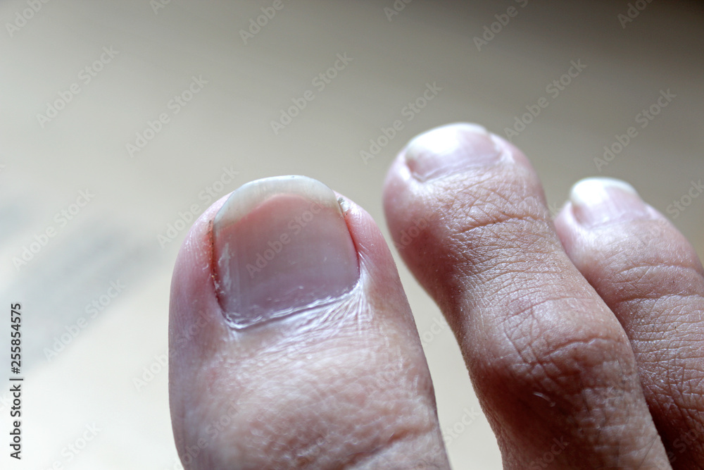 Big Toenail close up Big Toenail close up