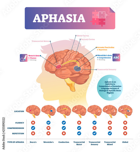 Aphasia vector illustration. Labeled educational scheme with brain disorder