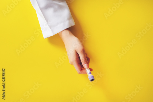Laboratory assistant holding test tube with blood sample on yellow background