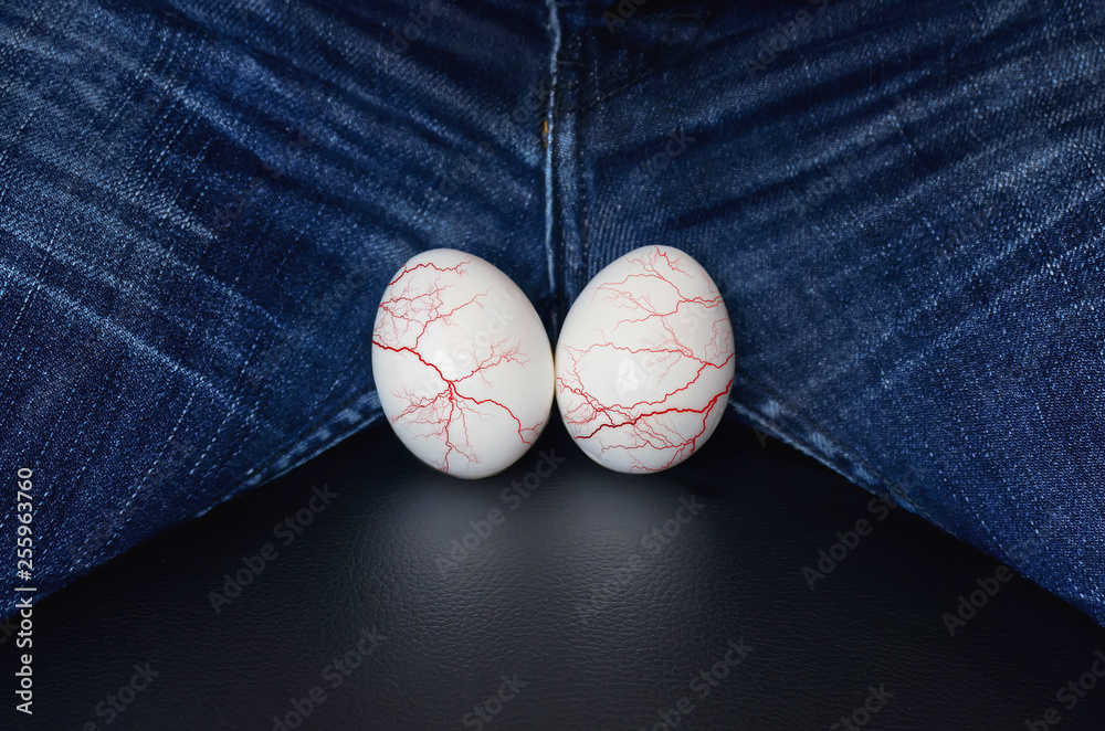 Foto de White eggs a symbol of man's balls. varicocele male disease