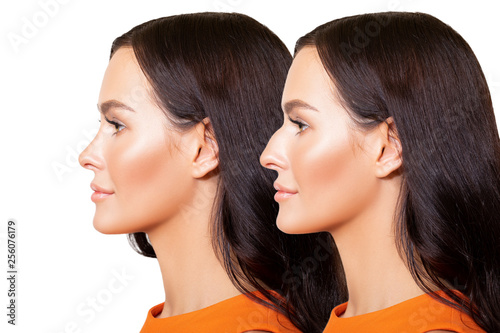 Comparison of Female nose after plastic surgery. portrait of beautiful caucasian young woman in profile is isolated on white background - Image.  photo