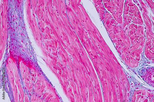Education anatomy and Histological sample Heart muscle Tissue under the microscope.