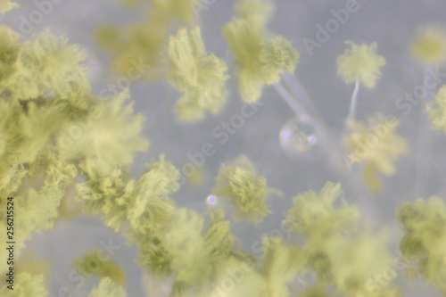 Close up of Aspergillus oryzae is a filamentous fungus, or mold that is used in food production, such as in soybean fermentation for education in laboratory.(soft focus and have Grain/Noise) photo