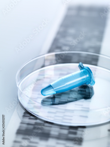 Eppendorf vial containing a human sample with the DNA autoradiogram results photo