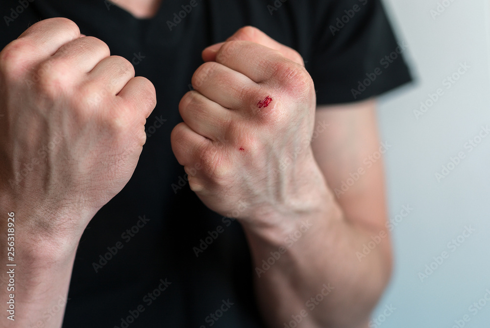 boxing fists with blood close up. motivation.