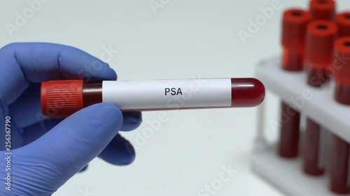 PSA, laboratory worker holding blood sample in tube close-up, health check-up photo