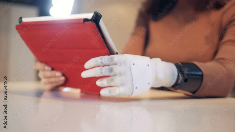 Woman with prosthetic hand uses a tablet, close up. Woman with prosthetic hand uses a tablet, close up.