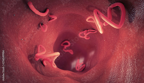 Tapeworm infestation in a human intestine - 3d illustration photo