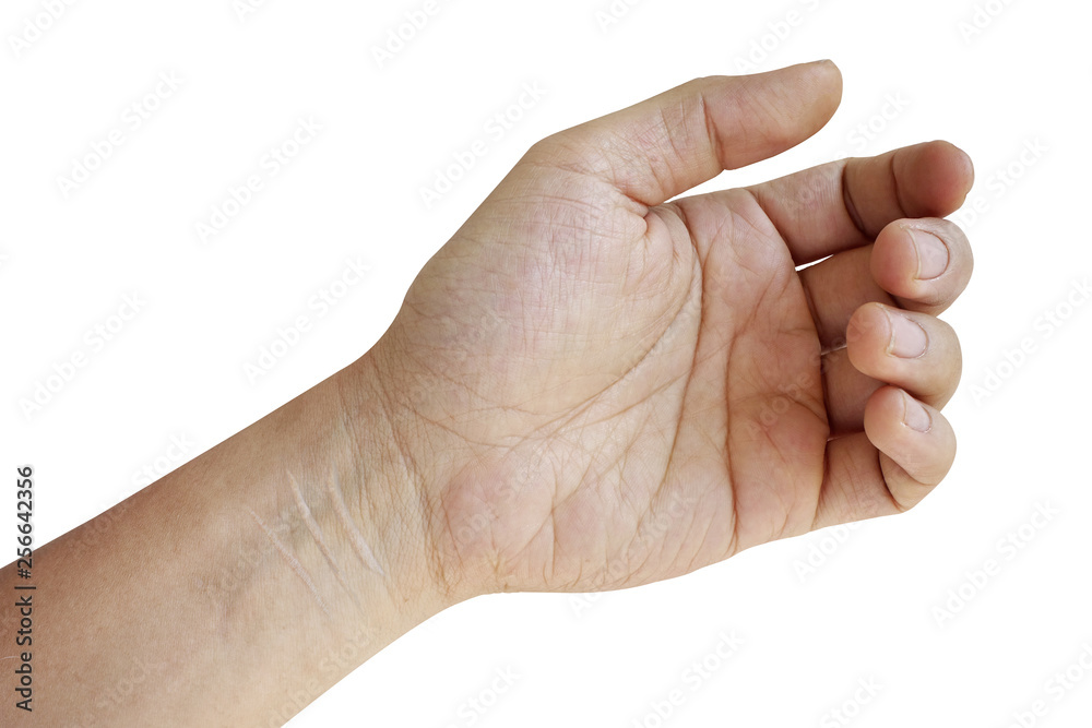 Hand with suicide scar on wrist isolated on white background Hand with suicide scar on wrist isolated on white background