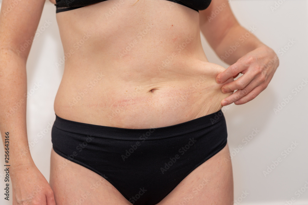 Fat female belly, woman holding her skin for cellulite check. Getting rid of belly fat and weight loss. Women body fat belly front view Fat female belly, woman holding her skin for cellulite check. Getting rid of belly fat and weight loss. Women body fat belly front view