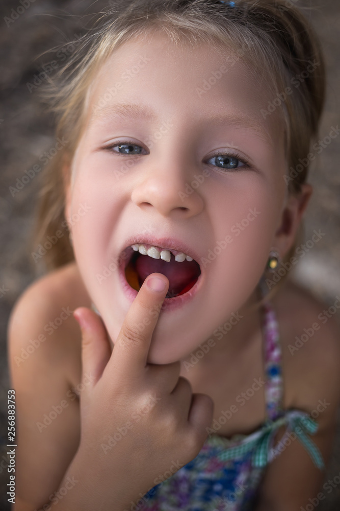 Little girl points the finger at a wobbly baby tooth Little girl points the finger at a wobbly baby tooth