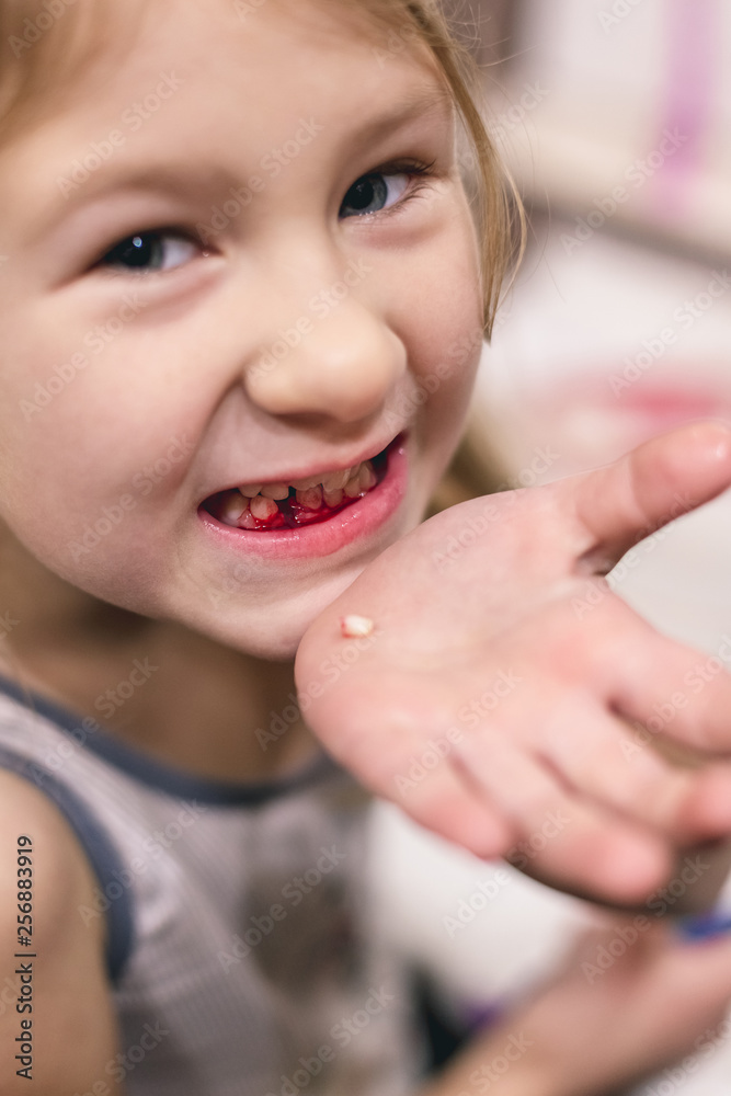 Cute little child has just lost the first milk tooth. Cute little child has just lost the first milk tooth.