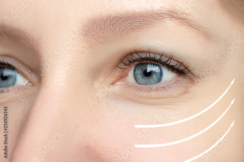 Принти на полотні Woman facewith perfect retouched skin - concept of rejuvenating cosmetological p