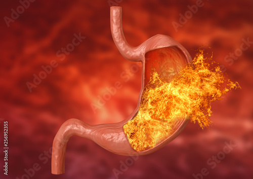 Photos stomach fire