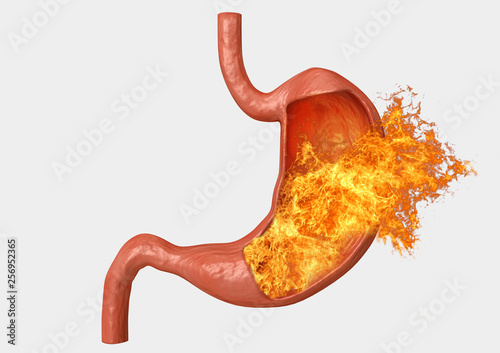 Foto stomach fire