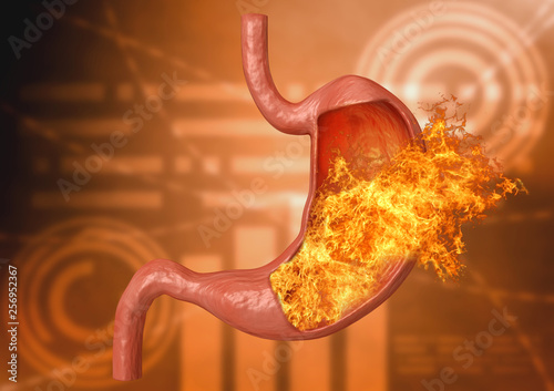 Φωτογραφία stomach fire