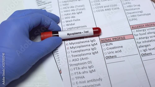 Mycoplasma, doctor checking disease in lab blank, showing blood sample in tube photo