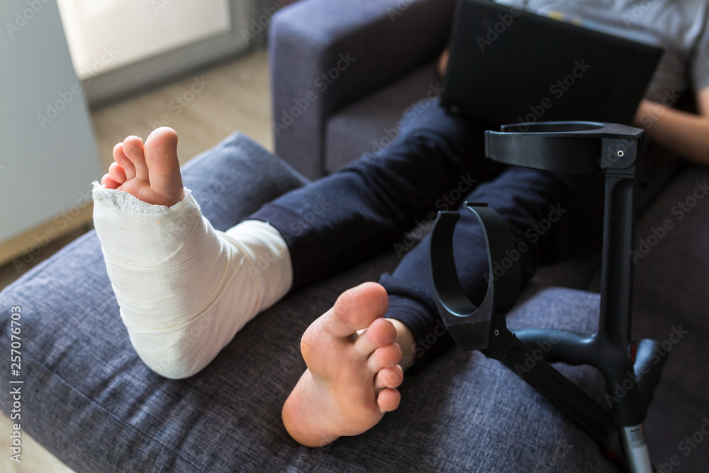 grounded at home with a leg in a cast grounded at home with a leg in a cast