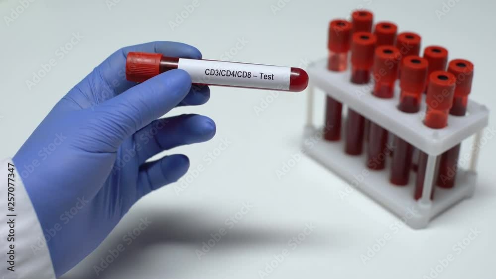 CD3 CD4 CD8, doctor showing blood sample in tube, lab research, health checkup CD3 CD4 CD8, doctor showing blood sample in tube, lab research, health checkup