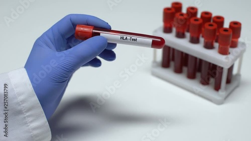 HLA test, doctor showing blood sample in tube, lab research, health checkup photo